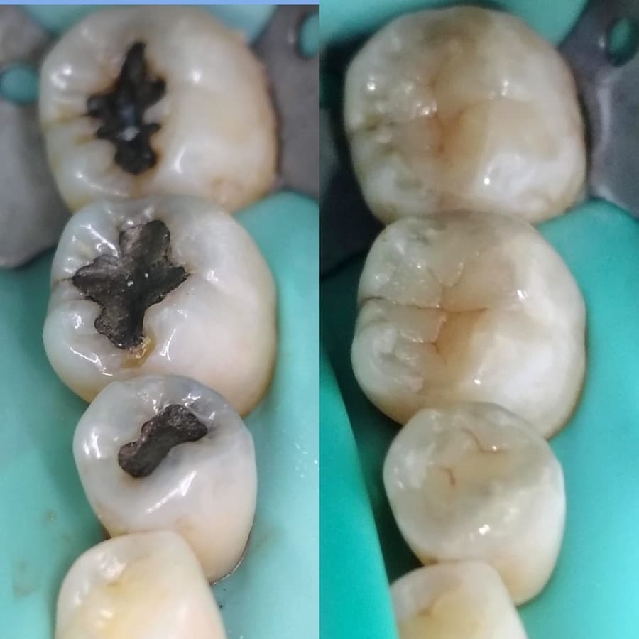 Antes e depois — Eduardo M.