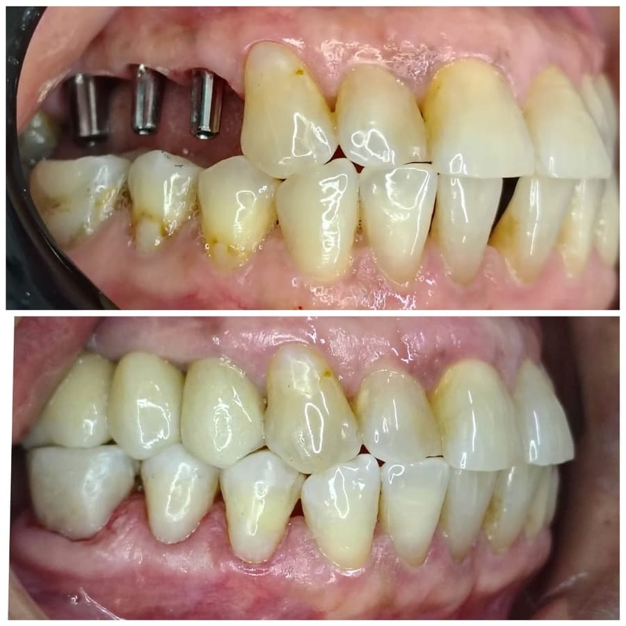 Antes e depois — Rodrigo A.